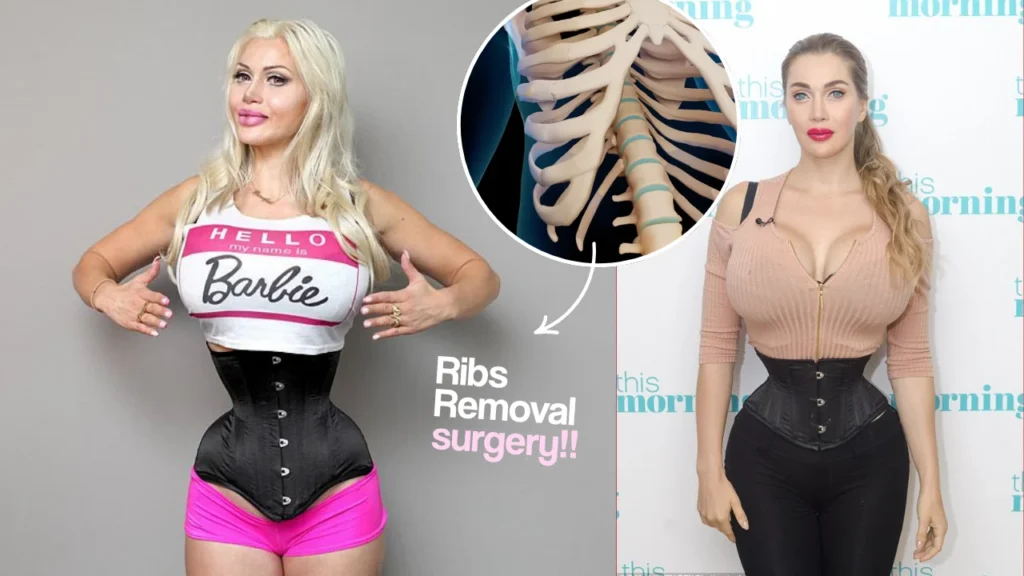 Rib Removal Surgery, What It Is, Why It's Done, and What You Should Know?