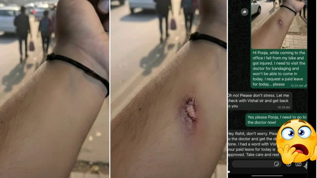 AI-Generated Injury Fool HR, Gets Paid Leave - Raises Big Questions